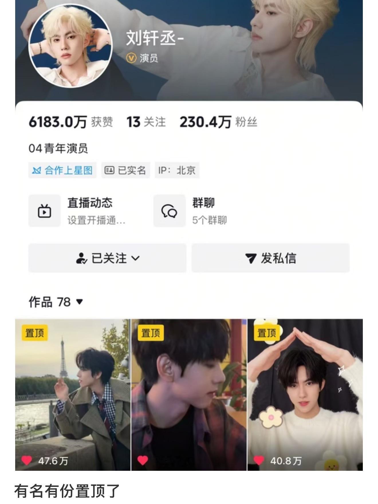 别人着急解绑，我家产还要过一周年呢💖💚展丞99
