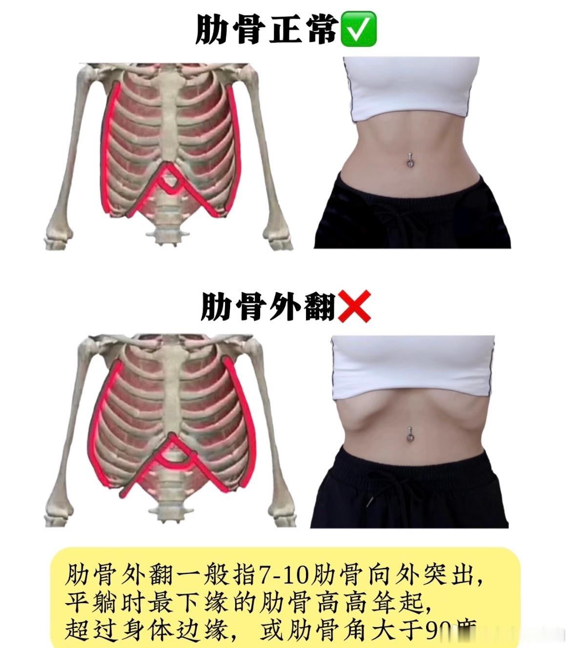 原来痛经真的和体态有关系可是我朋友还有家里人有肋骨外翻的，她们也不痛经啊，这个结