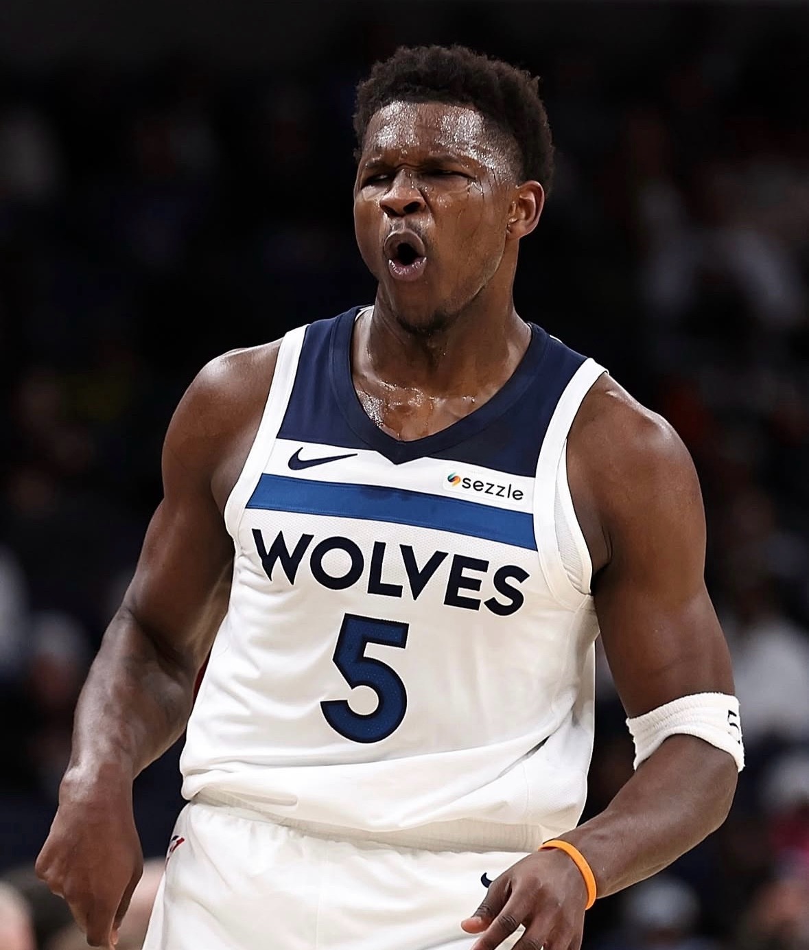 爱德华兹膝盖伤势的专业术语是髌股疼痛综合征，也就是我们常说的跑步膝。库里也曾因同