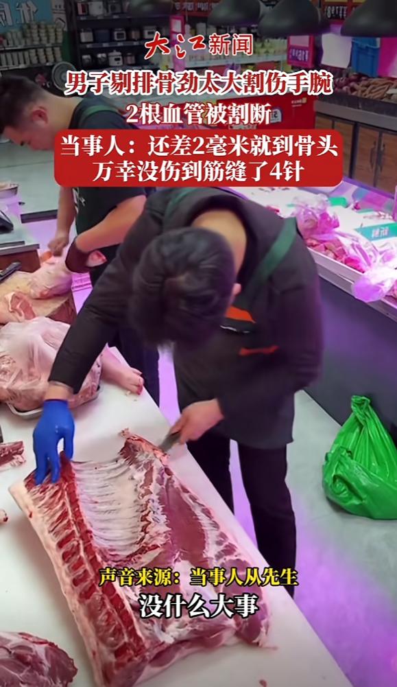 剔排骨翻车现场：浙江大哥失手割破两根血管，差2毫米见骨头！

谁能想到，剔个排骨