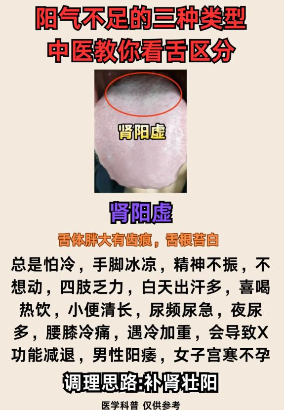 阳气不足 3 种类型，看舌象辨证区分