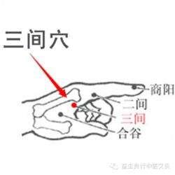 牙痛、手背肿？“三间穴” 在指根后
大家好，我是陈大夫！
牙痛、手背发胀肿痛，很