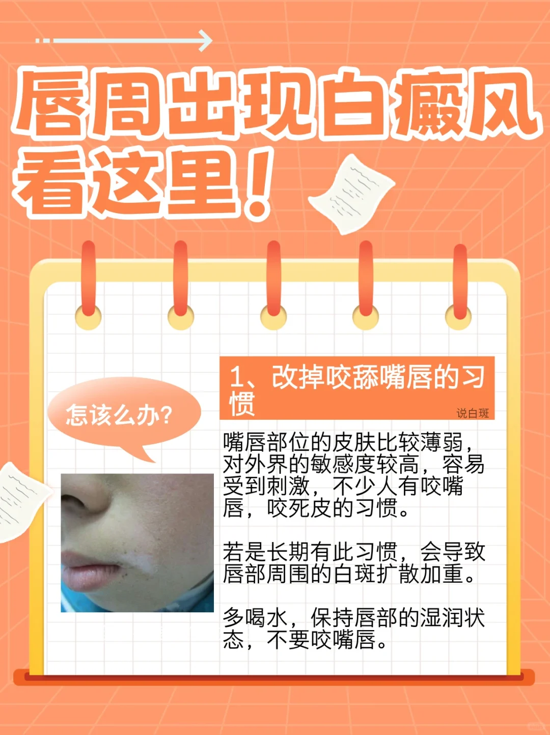 唇周出现白癜风怎么办？不要着急看这里！