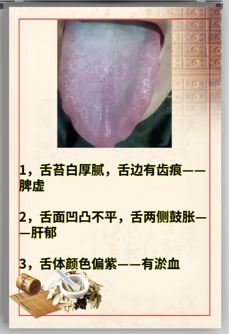 【公益舌诊】你发舌头照片，我来辨证分析！

最近有位不少朋友来找我看舌诊，根据大