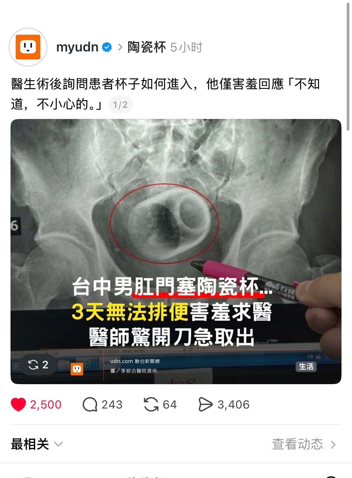 怎么又是不小心