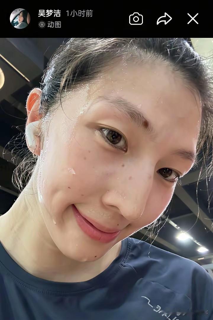 女排主攻手吴梦洁已经开始恢复训练了！
据悉在世联赛开赛之前受伤的中国女排的核心球