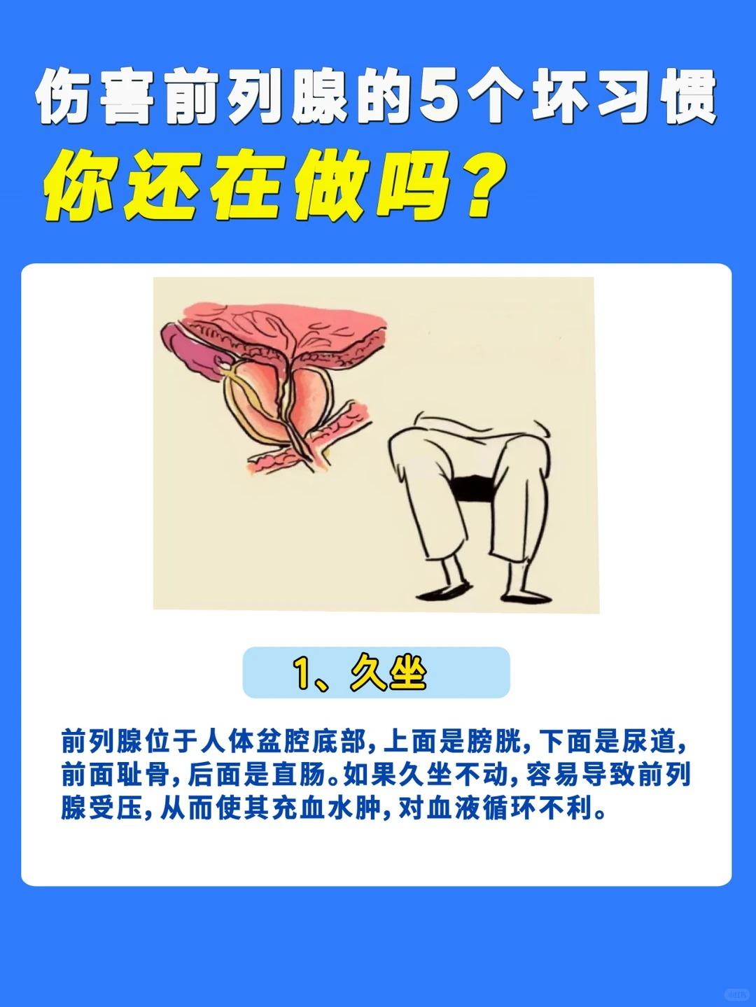 伤害前列腺的5个坏习惯，你占了几条？