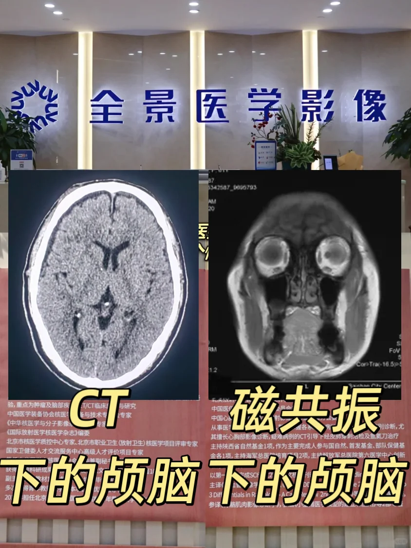 爸妈总头晕、忘事？「父母体检」指南别错过