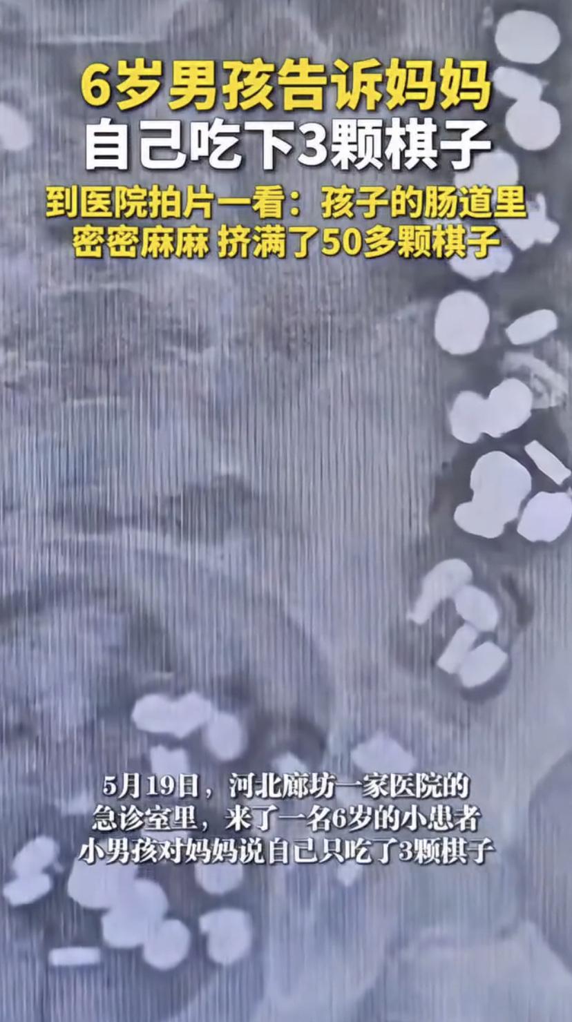 6岁娃说吃了3颗磁力珠，结果肚子藏了50多颗!医生都惊了
河北廊坊一个6岁小男孩