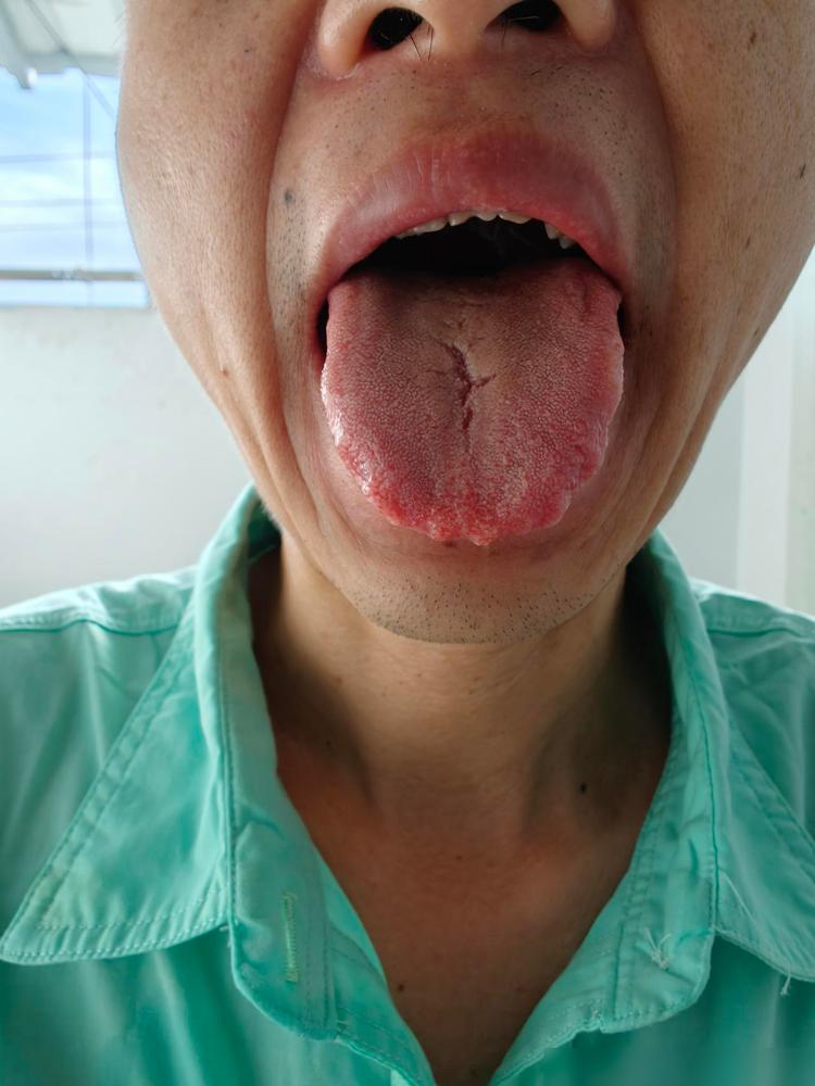 说出来你们可能不信，我治了快5年的脾胃病，前前后后砸了小两万没见好，最后居然挂个