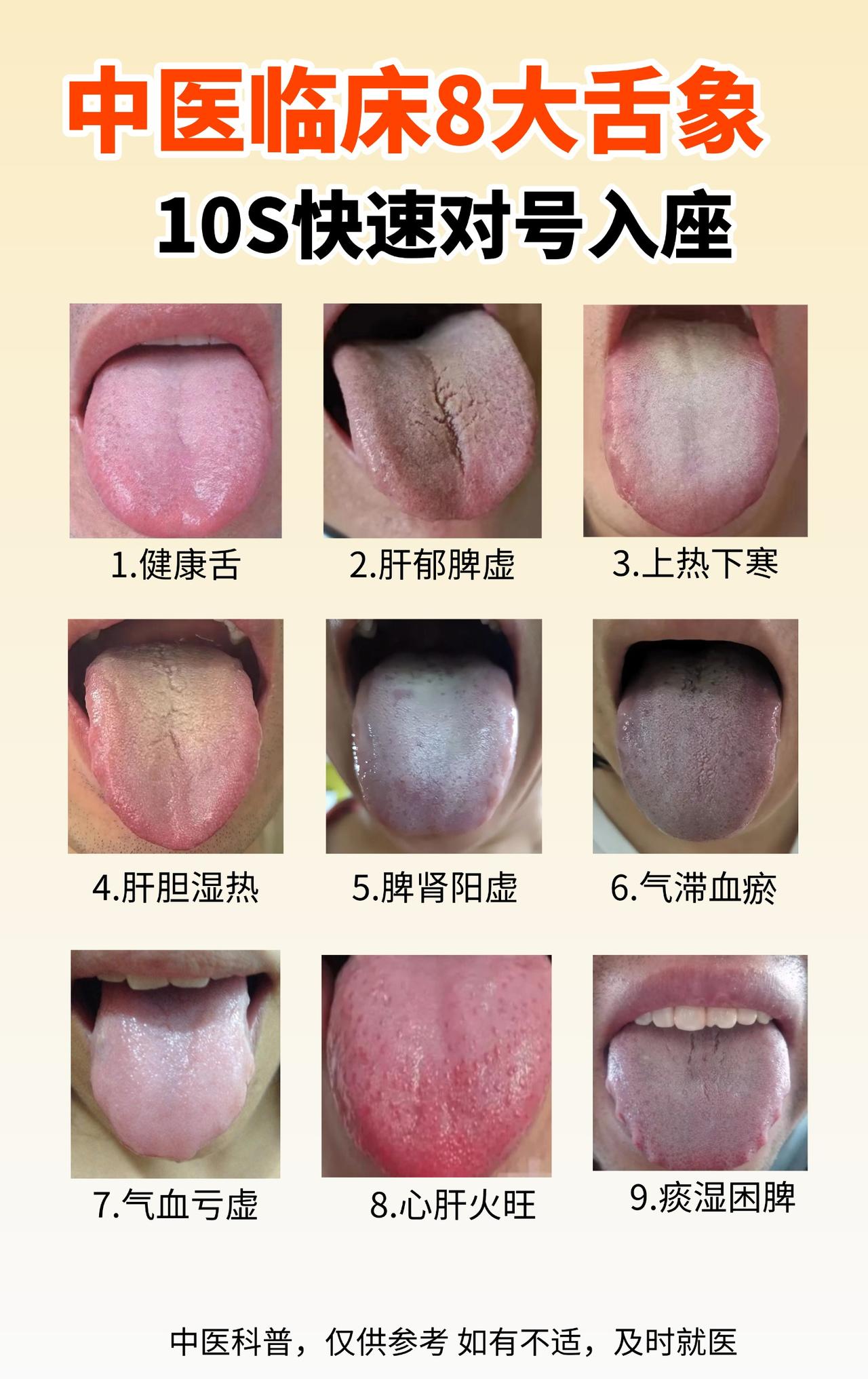 一张图快速学会中医八大体质，10S对号入座，内附调理建议
1.健康舌象：舌苔薄白
