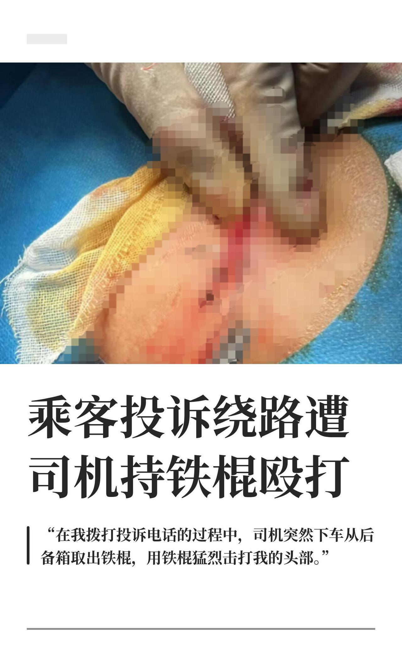 这事儿真挺离谱的。7月20号凌晨两点多，太原成先生喝了点酒在亲贤北街体育路口上了