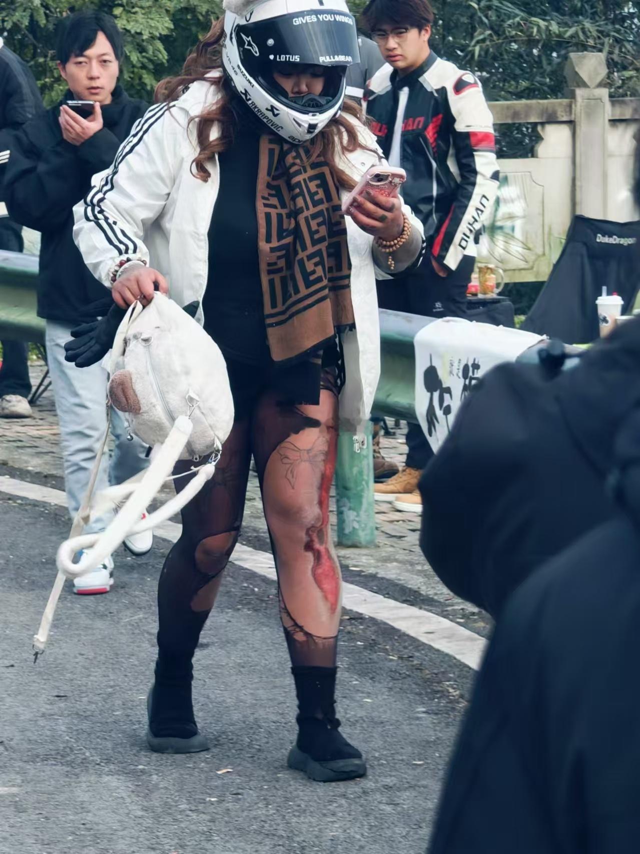 黑丝女骑没受伤让别人看，受伤了还是让别人看，这黑丝穿的意义就是~~~希望以后别受