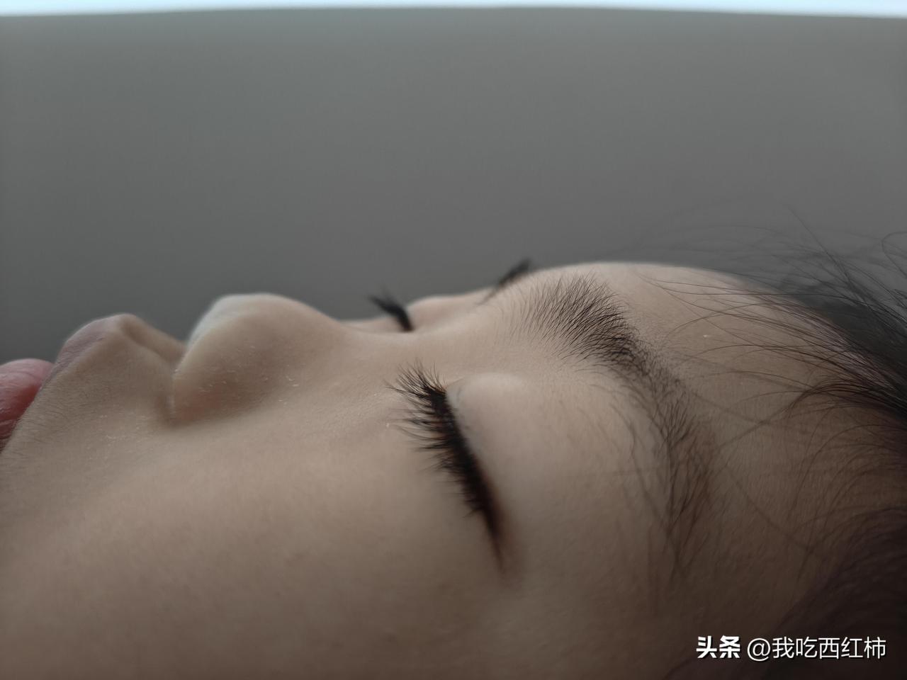 请问这个是鼻小柱缺失吗？
娃6岁了，鼻子还是这样塌塌的，是不是鼻小柱缺失啊，鼻头