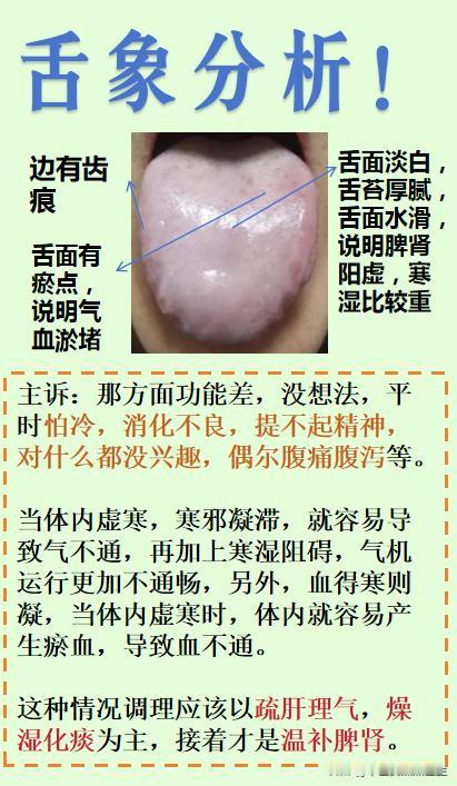 【舌象分析——这种寒湿重，气血瘀滞的舌象，调理顺序很重要！】

免费帮大家分析舌