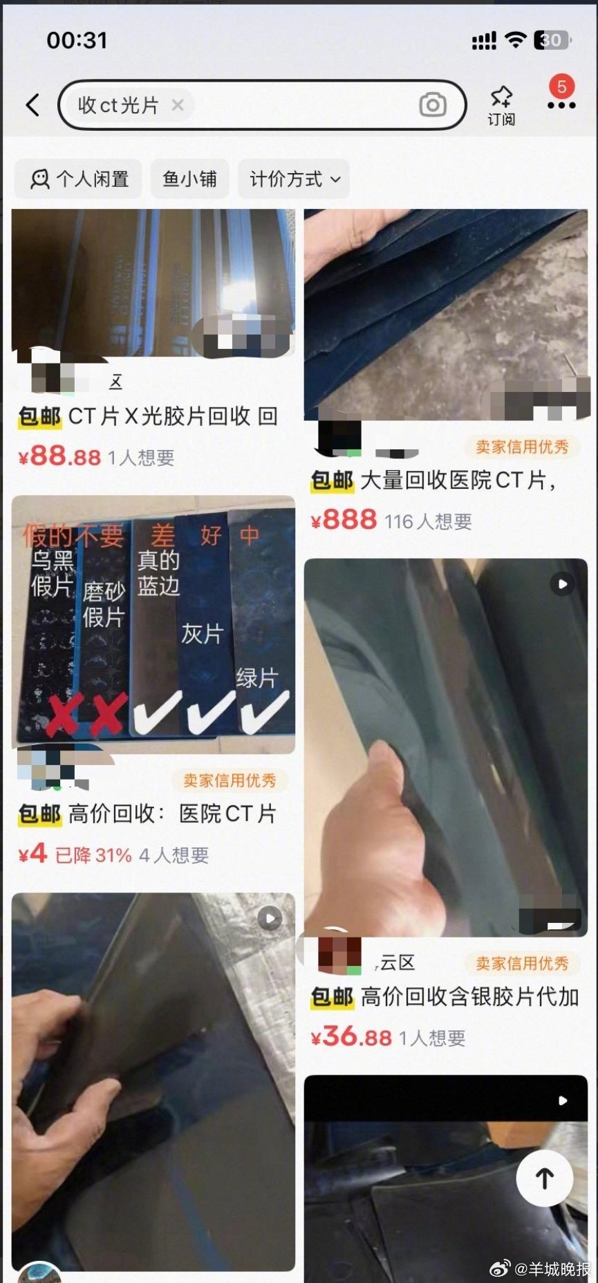 【1.5元收旧CT片？别卖！#非法炼银污染还致癌#】“1块5一张，不挑好坏，假片