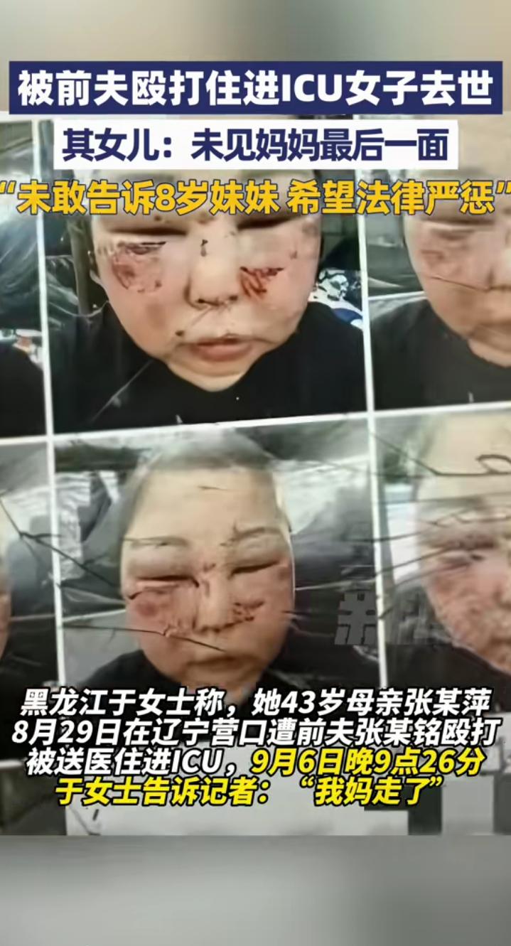 43岁女子被前夫殴打生命垂危，前夫竟然撒谎:“她在院子里摔倒，摔成这样的。”8岁