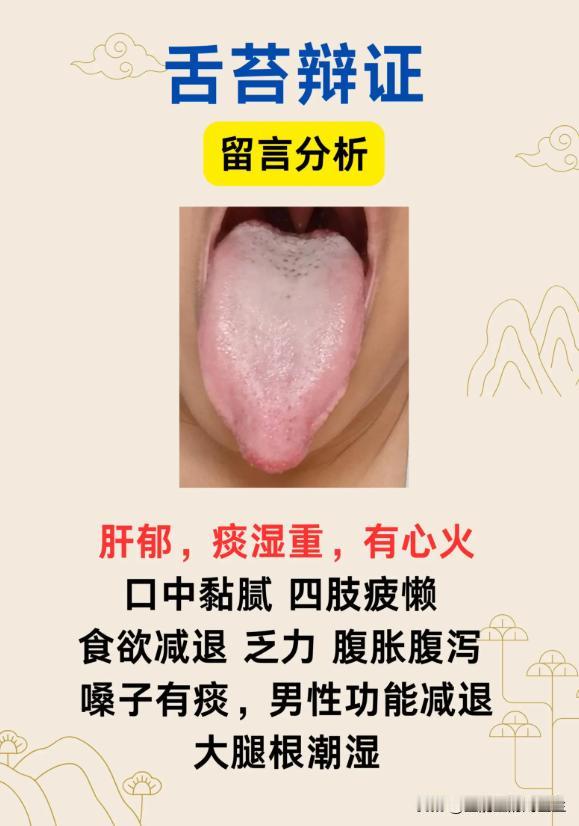 从舌象看体质：肝郁、痰湿、湿热证型的典型舌象解析