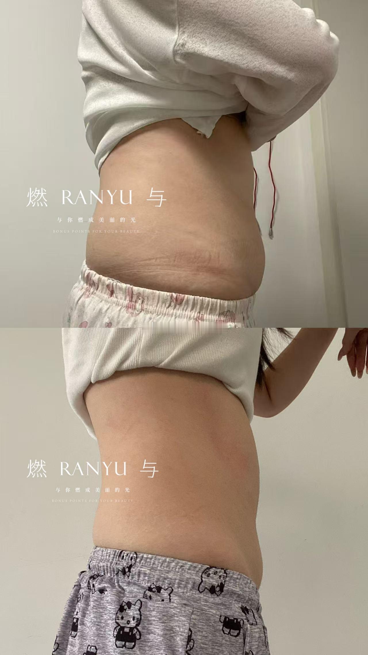 ⚠️限定款·至尊款·顶配版·超强版每天只喝半包的量 仅限𝟖月第一批新可可𝟗月