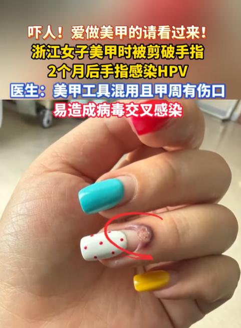 悲剧还是发生了！5月23日美丽浙江报道，浙江，一女子在美甲店修剪死皮时，不幸被未