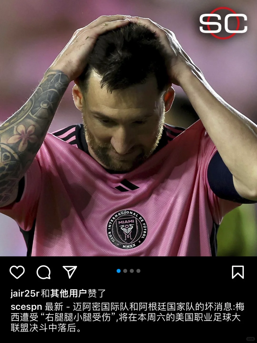 梅西右腿受伤，不会参加周日凌晨的比赛