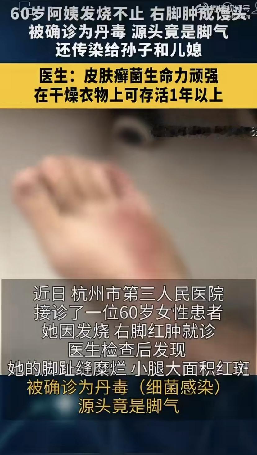 祖孙三代全中招!只因奶奶脚上这个“小毛病”，全家遭殃
杭州一位60岁大妈，前阵子