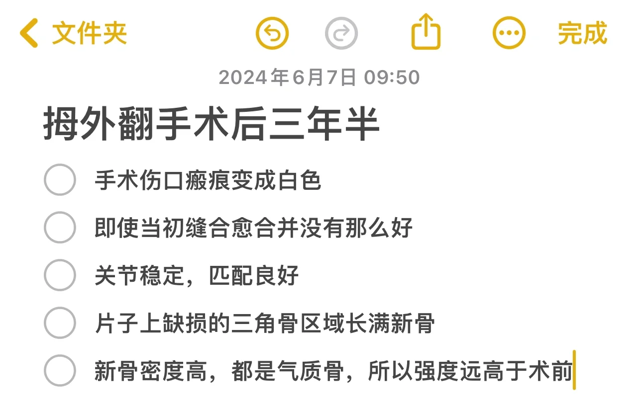 拇外翻术后三年半