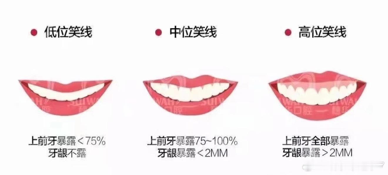 我发现露上牙说话和露下牙说话的区别确实挺大，平时聊天露上牙，不管笑不笑，都显得这
