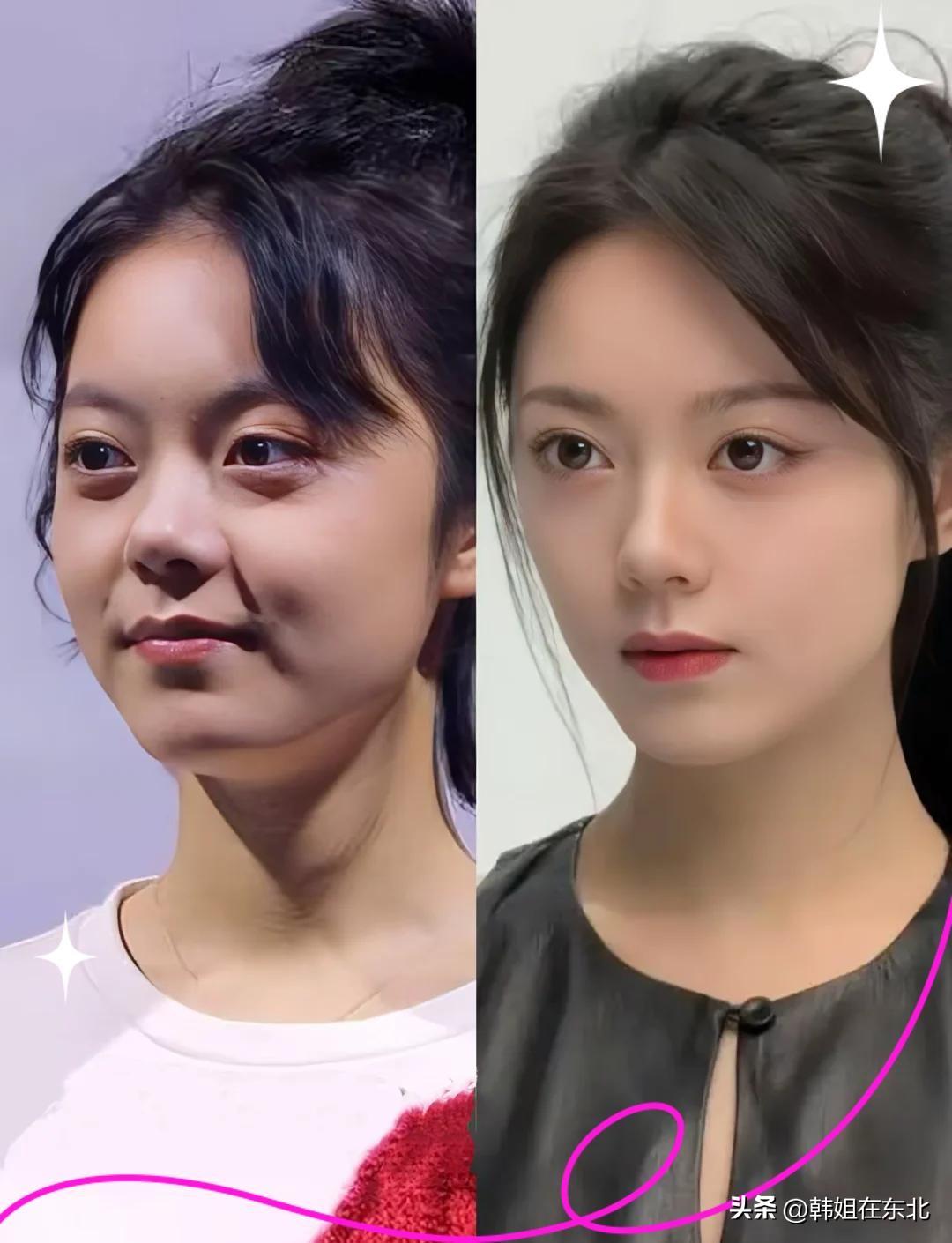 演员赵今麦胖瘦两张脸，你们更喜欢哪边？评论区聊聊！