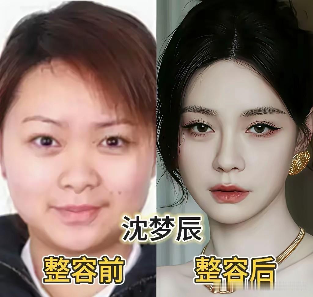 娱乐圈很多女星医美调整之后，颜值精致了不少，她们只微调短板，保留自身特色，自然又
