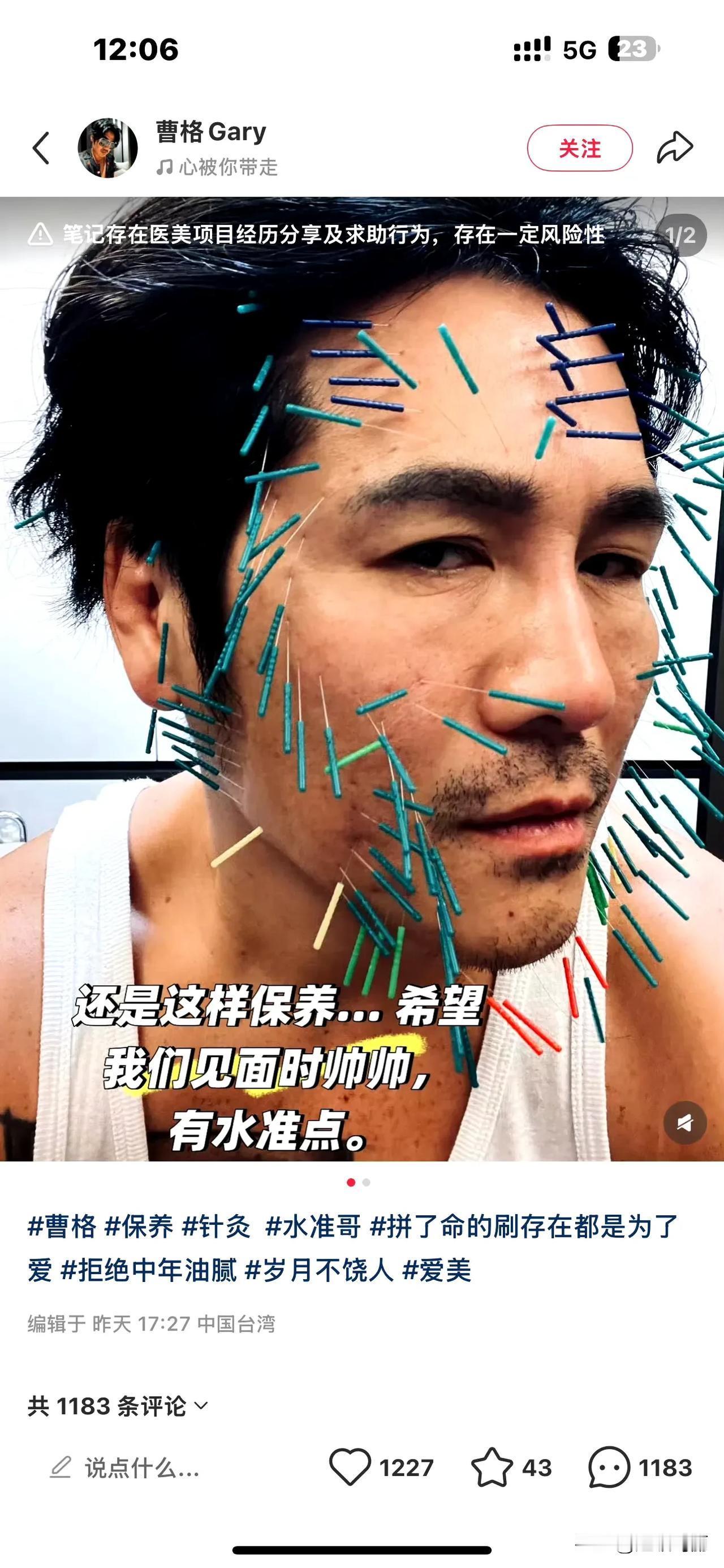 医美界到底能整出多少幺蛾子[捂脸]
对曹格的印象还是醉酒打人 无数次戒酒失败又给