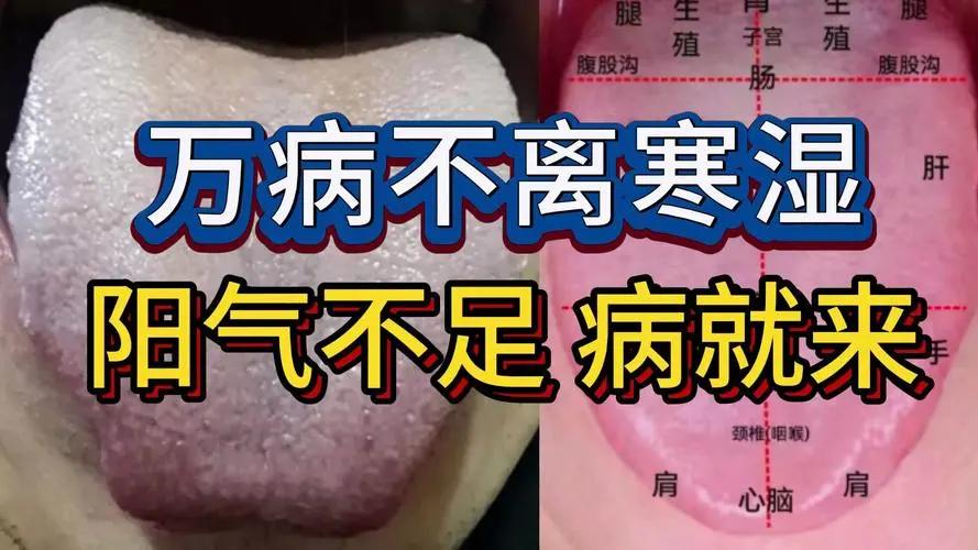 白带异常和寒湿下注有关
如果遇到白带水样、清稀的情况，这个可以考虑阳虚水泛的问题
