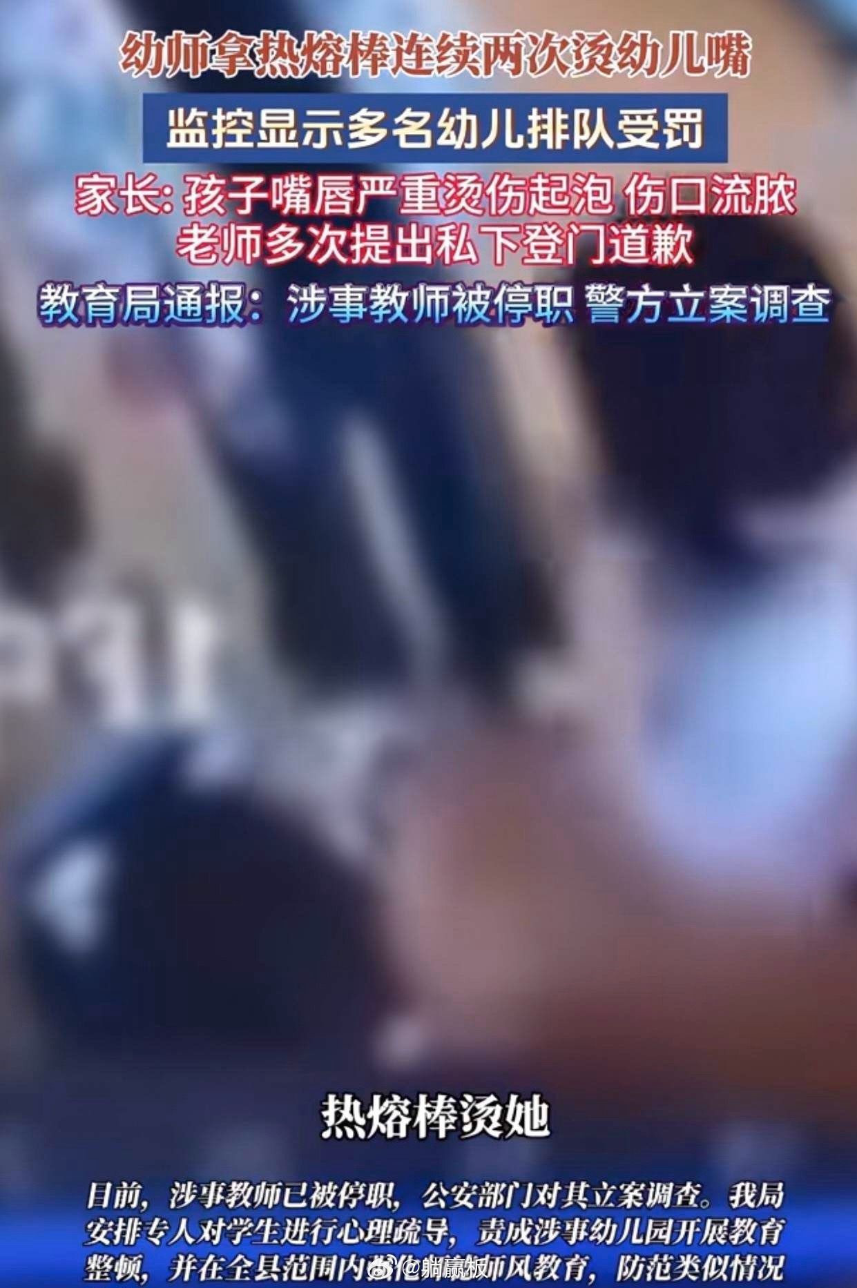 问了当医生的闺蜜才知道，为什么丰县那个幼师拿着热熔胶，特意去烫孩子的上唇尖！那是