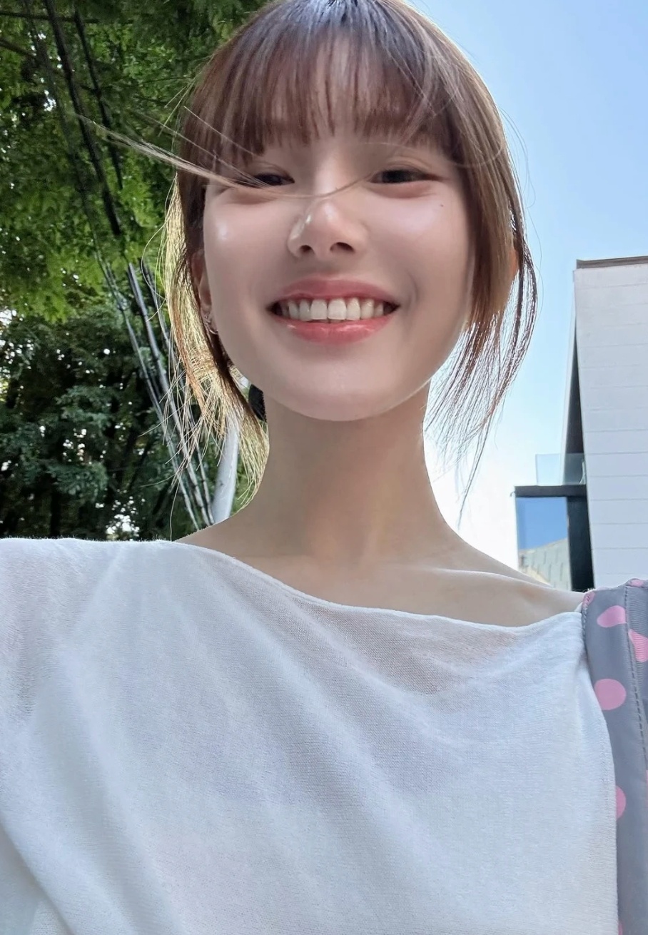 赵露思怎么变成这样了，都有点惊悚了 