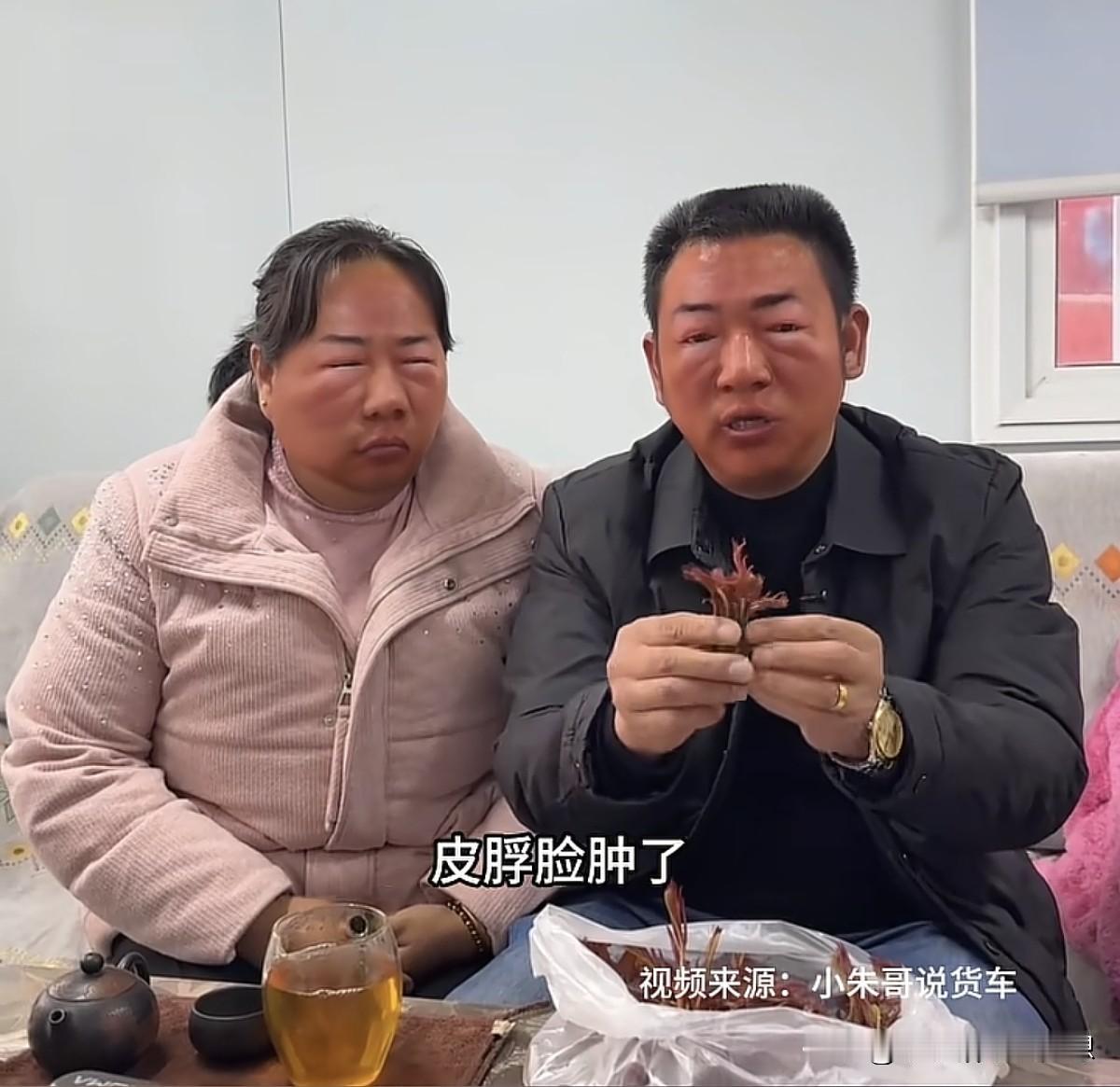 “客户太热情也不一定是好事，给我送的东西，吃的我一脸包！”看了这个视频，笑死我了
