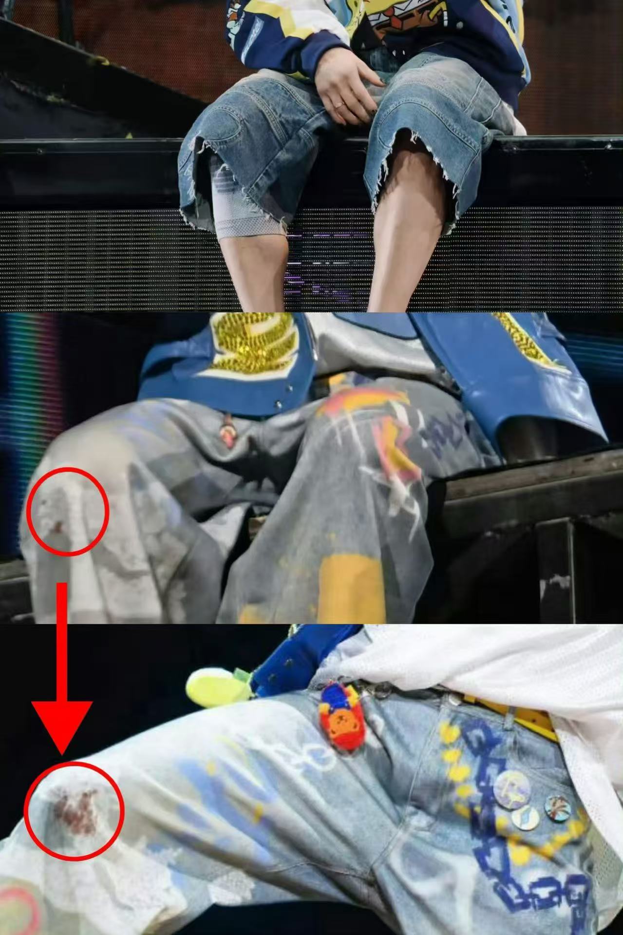鹿晗膝盖疑似流血鹿晗裤子上的血迹鹿晗腿伤还没好 鹿晗腿伤还没好，是谁还没看到鹿晗