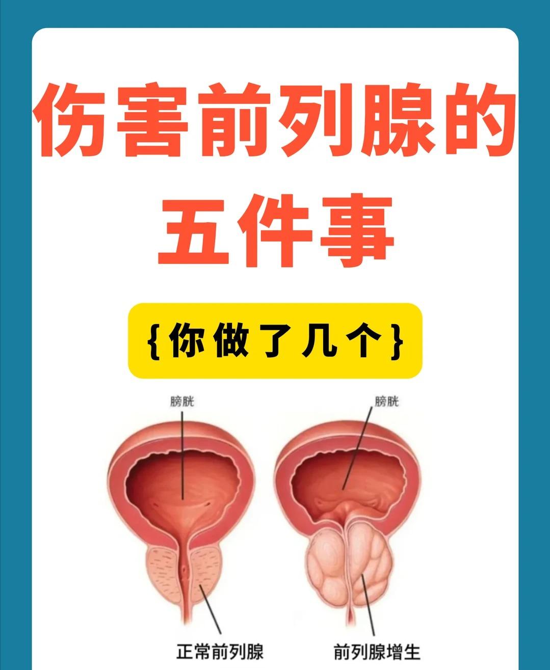 伤害前列腺的 5 件事，男性尽量少做