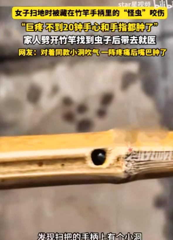 太倒霉了！四川雅安，一位女子在家里扫地时，竟被扫把柄里窜出的一只“怪虫”狠狠咬了