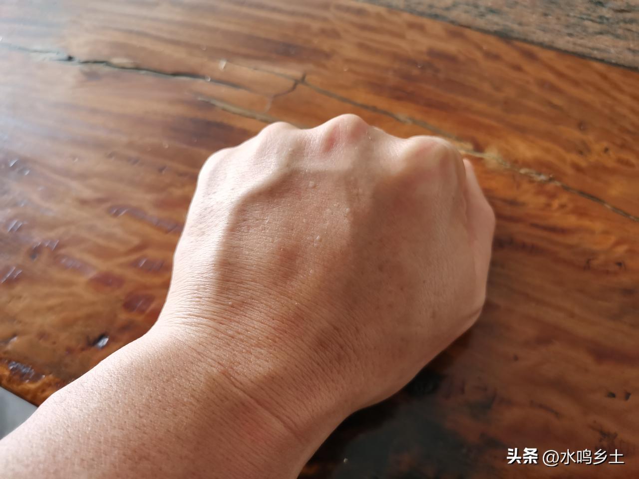 40岁，我竟在手上发现了老人斑！看着那几颗突兀的小斑点，瞬间慌了神。明明还不到中