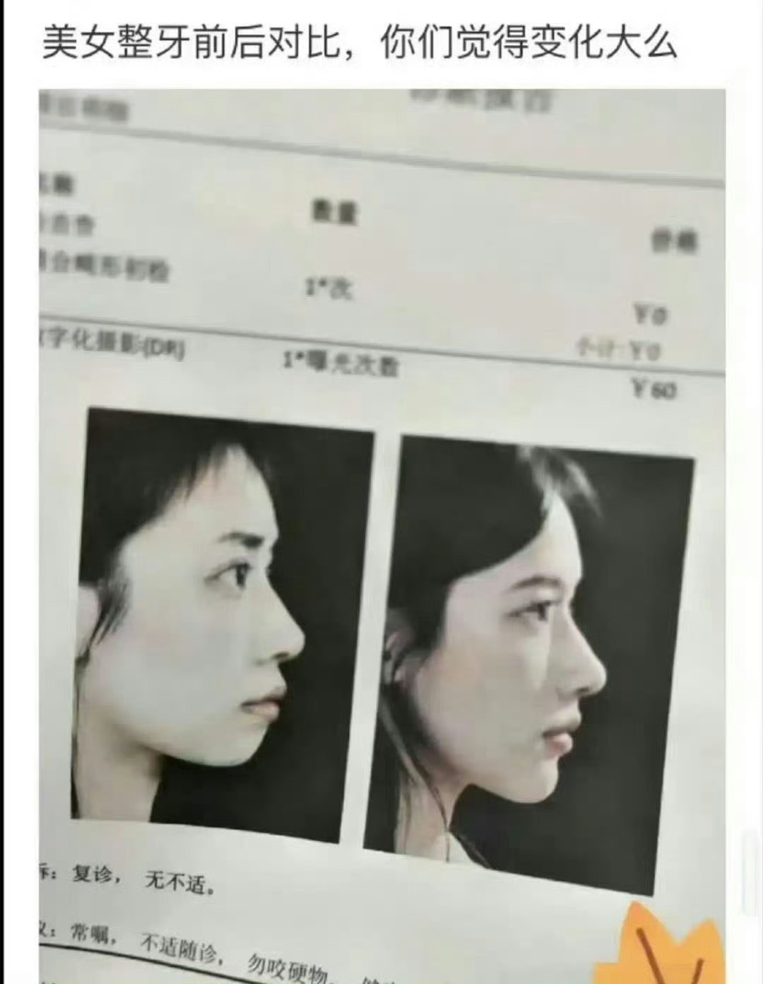 这哪是整牙的变化啊，这简直像是换了一个人 