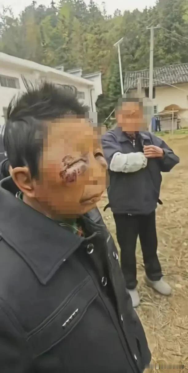 七旬相伴，竟挥拳脚？平江这场晚年家暴戳痛人心
 
湘北的冬日透着刺骨的凉，可比寒