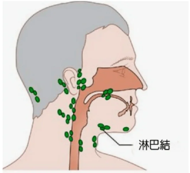 甲状腺乳头状癌