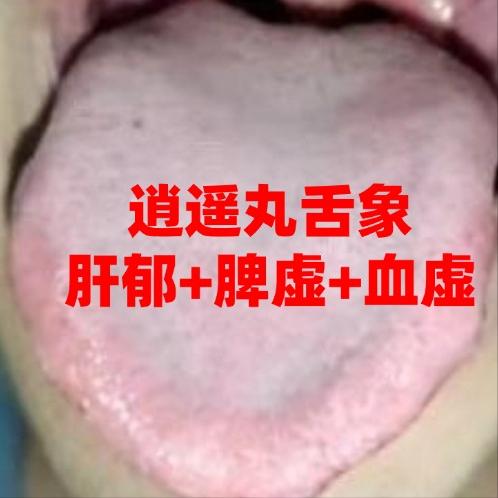 肝气郁结、肝郁化火湿热、肝郁脾虚血虚？3 类肝郁证型对症调理指南

1，肝郁+脾