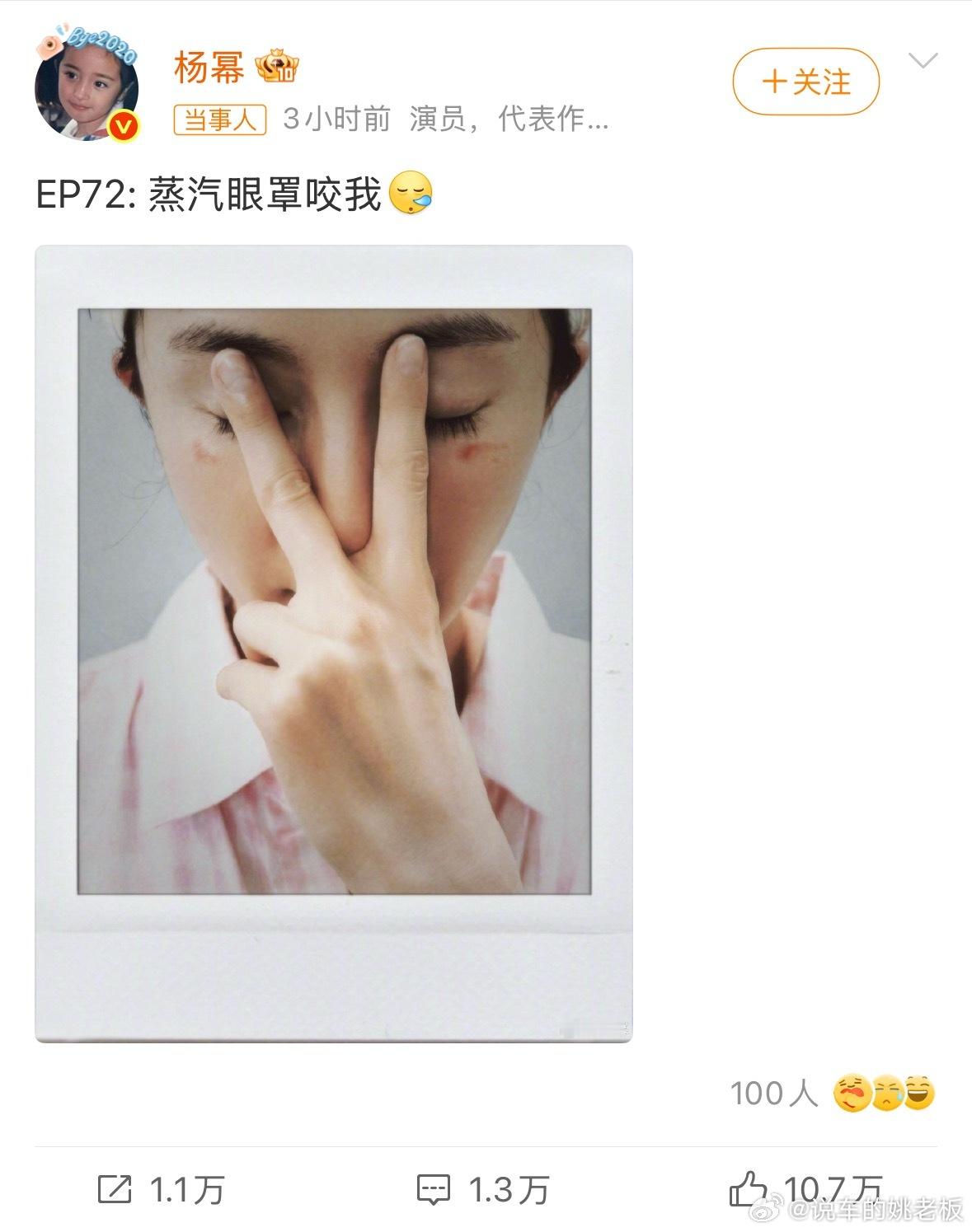 4月27日，杨幂发文调侃蒸汽眼罩咬我，晒出的照片里眼下方有明显红痕，疑似低温烫伤