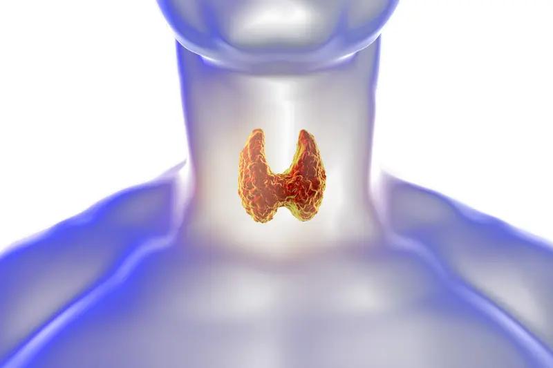 女性为什么更容易得甲状腺结节是女性更容易得甲状腺结节，这跟我们女性的身体结构，抗