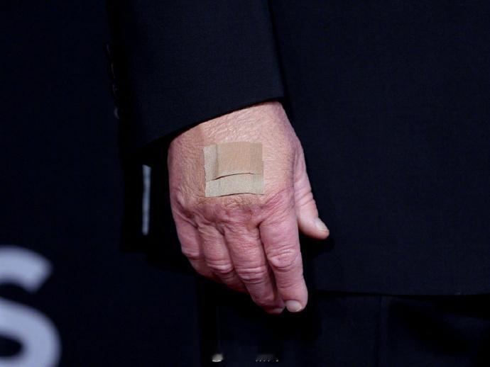 特朗普承认服用阿司匹林老头还算诚实。近八十岁的人了，人体有点小毛病很正常。特朗普