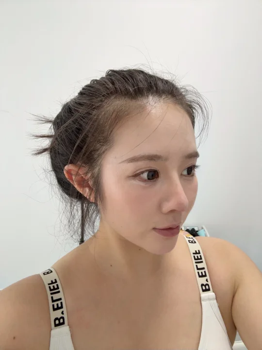 后续来啦菲林普利第五天