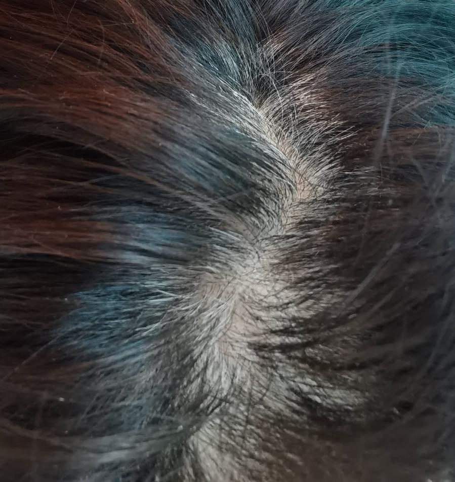 男人的头发为啥要一月一理呢？
吴大姐的丈夫头发并不多，还有点稀疏，但总是一个月一