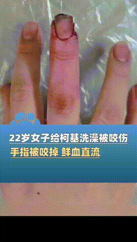 太悲催了！河南，一名22岁的女子在给宠物狗柯基洗澡时，竟被这只小型犬疯狂咬伤，直