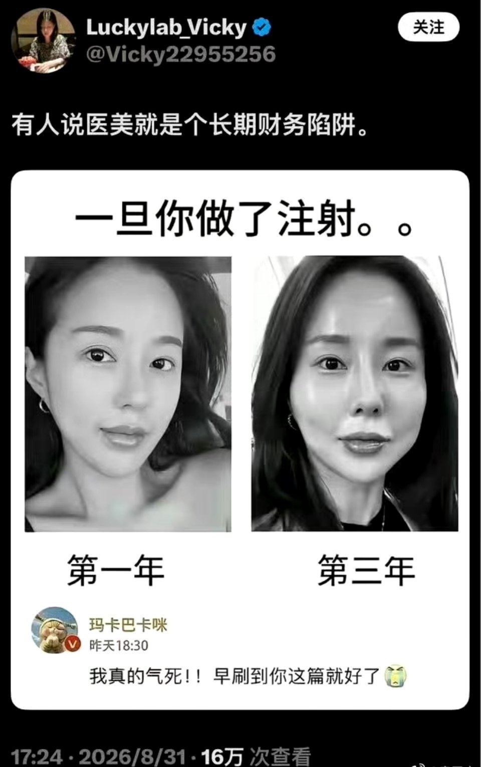 有人说医美就是个长期财务陷阱，比如韩国前第一夫人金建希 ​​​